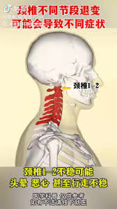 颈立康使用效果怎么样